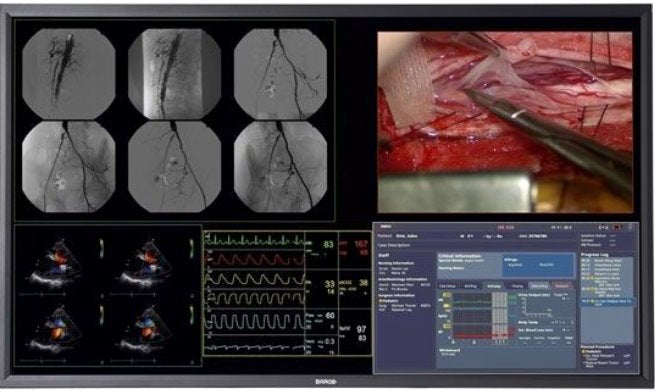 MONITOR, MDSC-8358 MNAG Medical BARCO 